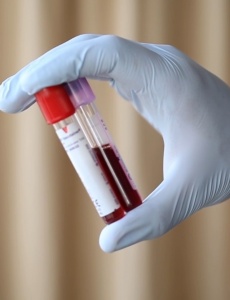 Doação de sangue segue em baixa após excesso de casos de dengue em Pará de Minas