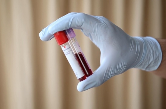 Doação de sangue segue em baixa após excesso de casos de dengue em Pará de Minas