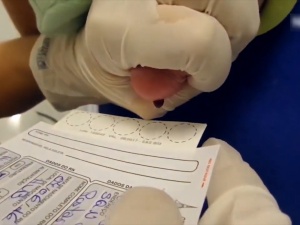 Teste do Pezinho é ampliado em Minas Gerais e passa a abranger mais de 60 doenças raras