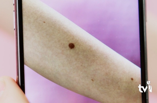 Dezembro Laranja: campanha conscientiza sobre a prevenção ao câncer de pele
